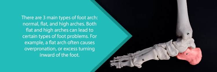 foot arch
