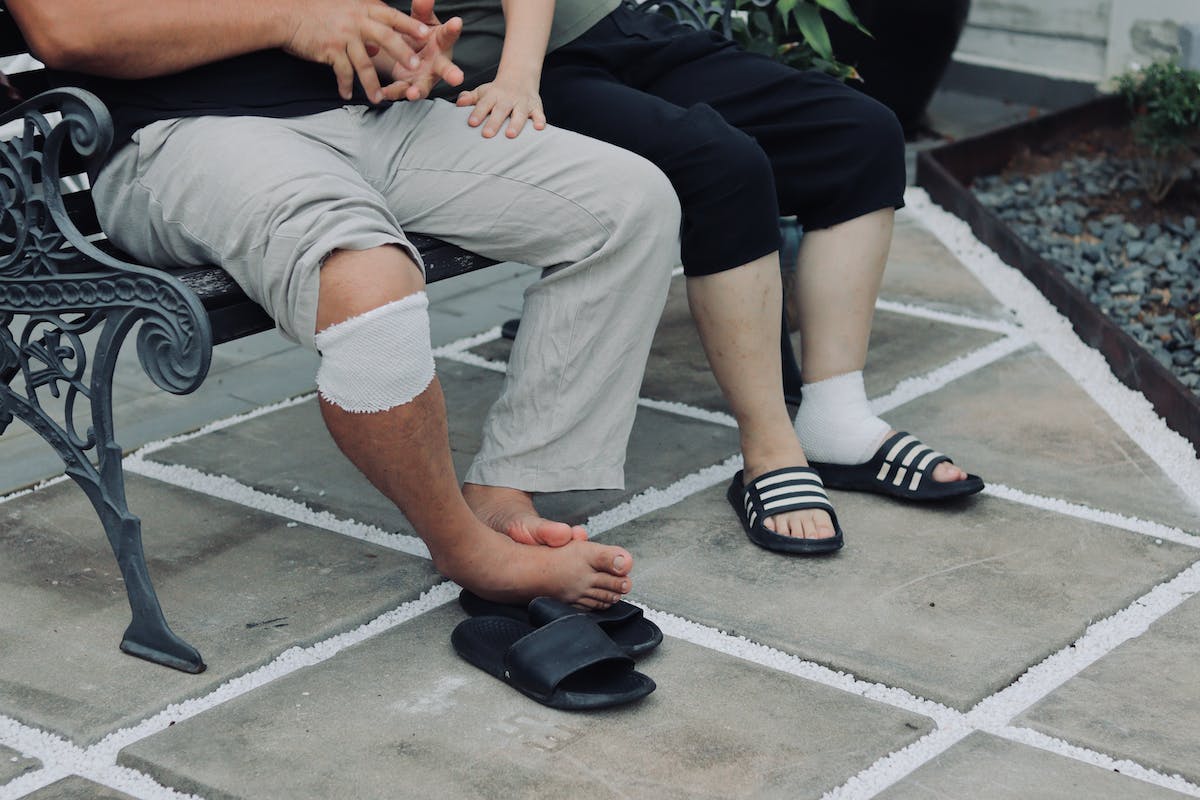 Bandaged Legs of a Couple Sitting on a Bench