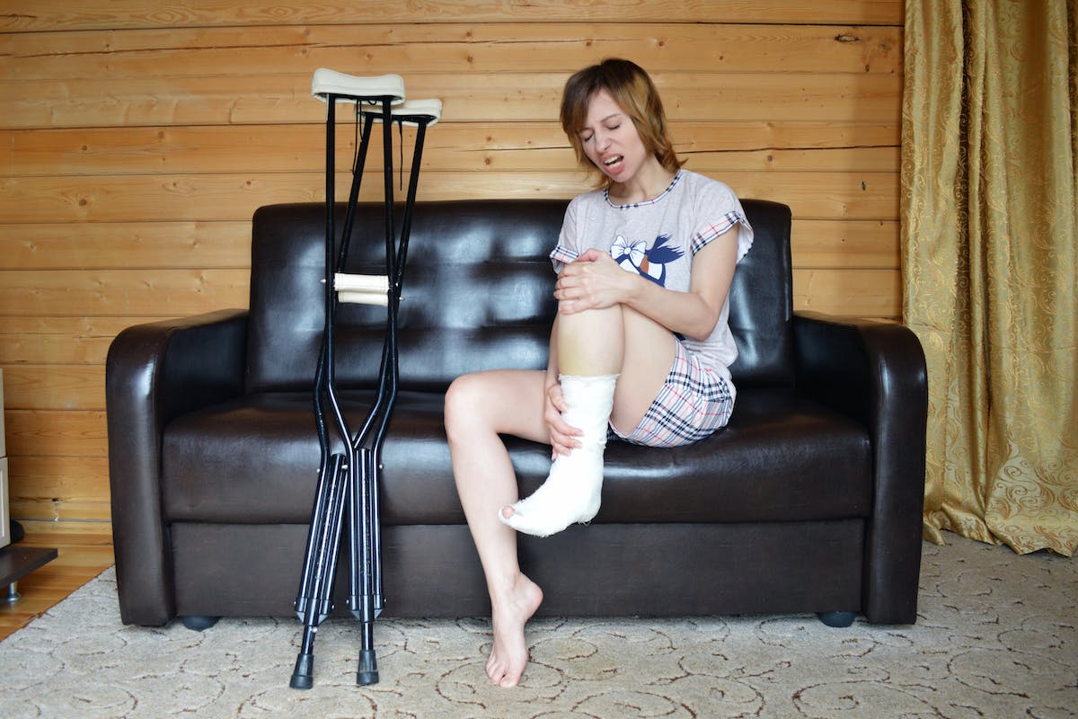 Young woman holding broken leg in cast